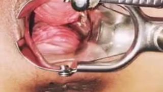 Cervix Porn and Sex Videos - XXNX